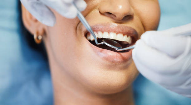 Best Urgent Care for Lost Fillings or Crowns in Hesperia, CA